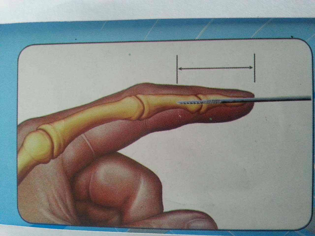 34
